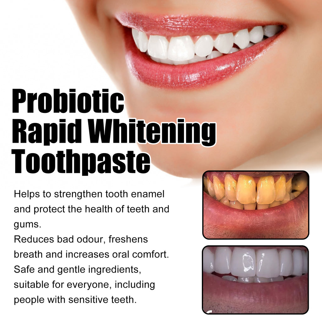 Dentifrice Probiotique Blanchiment Rapide — Anti-Tartre, Anti-Odeur & Dents Blanches