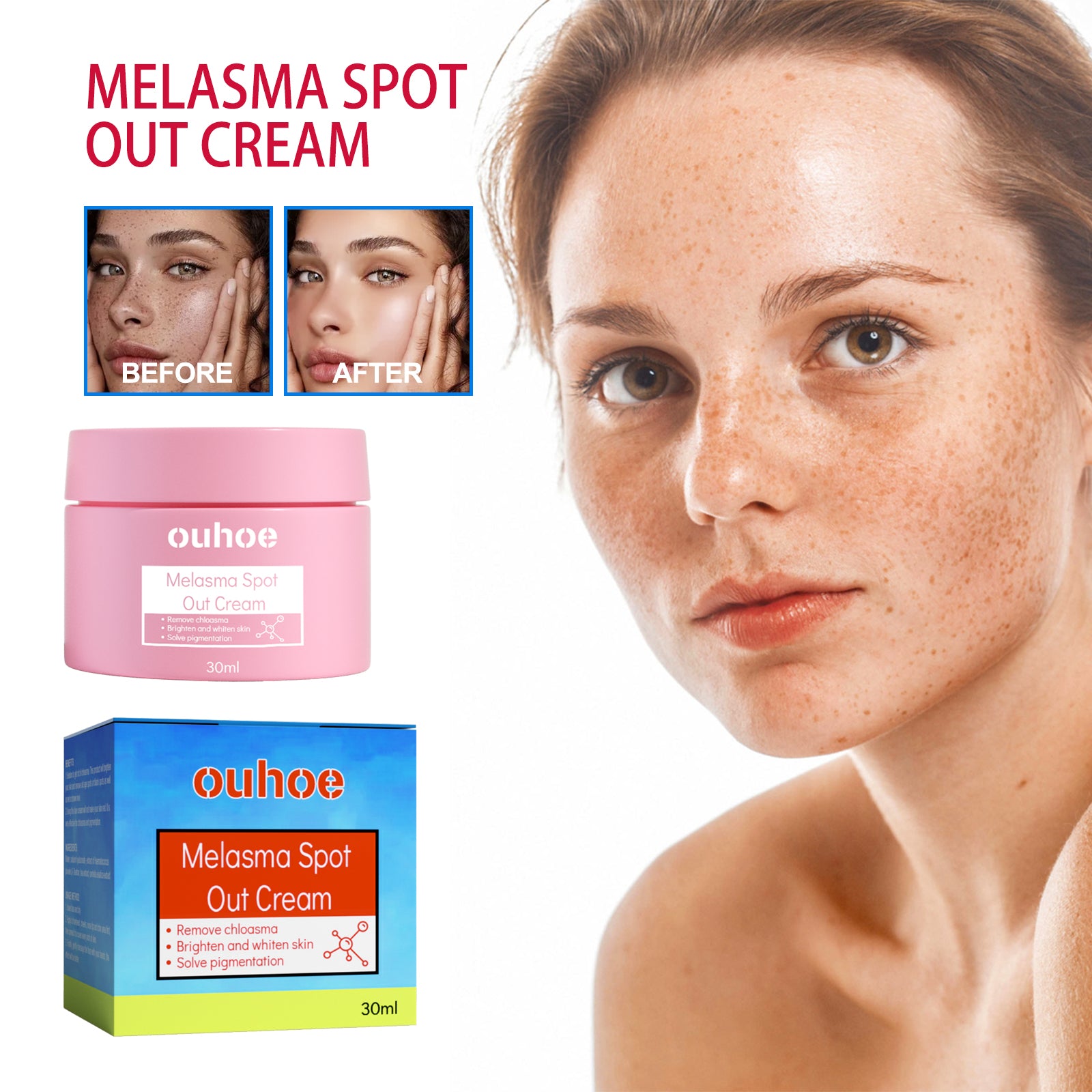 Crème Anti-Taches Mélasma — Blanchissante, Hydratante & Teint Uniforme