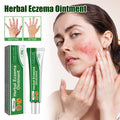 Pommade Herbes Eczema — Anti-Rougeurs, Anti-Démangeaisons & Réparatrice Mains & Pieds