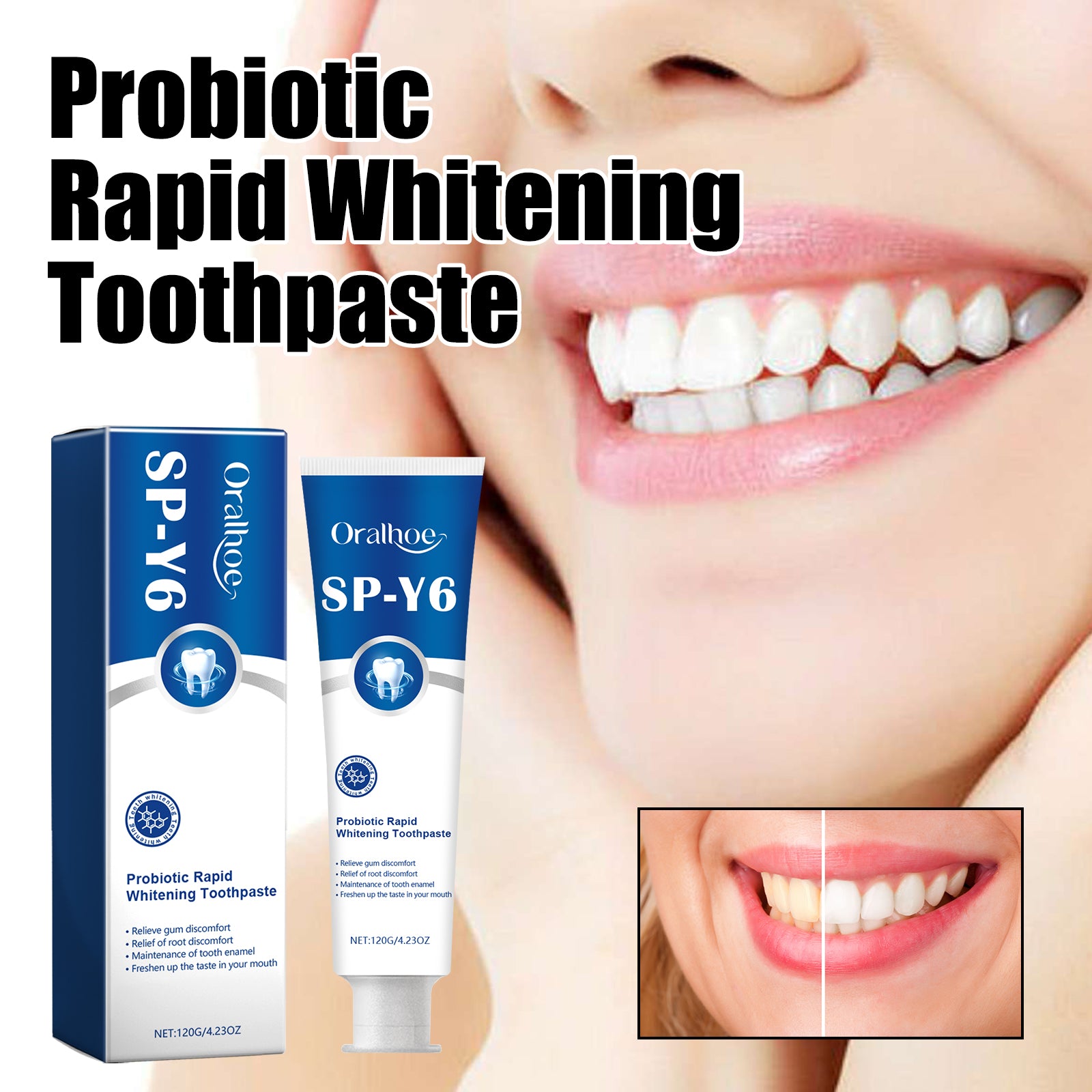 Dentifrice Probiotique Blanchiment Rapide — Anti-Tartre, Anti-Odeur & Dents Blanches