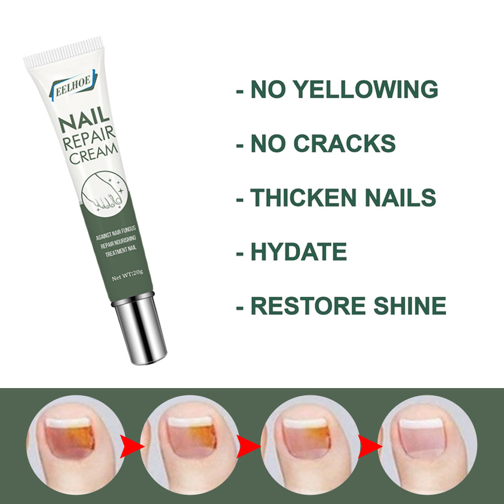 Crème Soin Ongles & Pieds — Réparatrice, Nourrissante & Ongles Renforcés