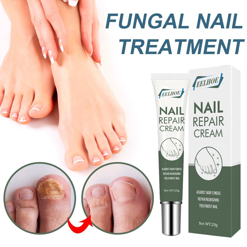 Crème Soin Ongles & Pieds — Réparatrice, Nourrissante & Ongles Renforcés