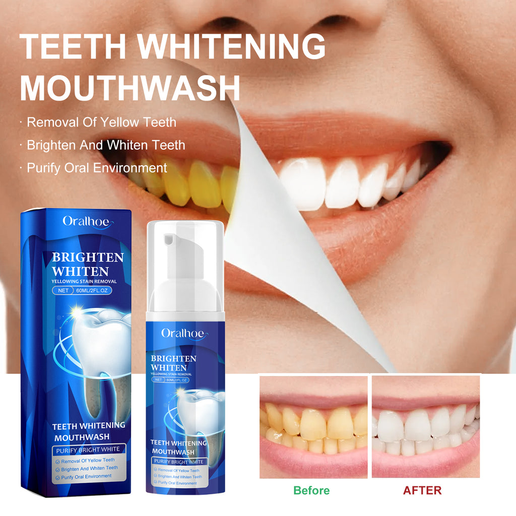 Bain de Bouche Blanchissant Premium — Anti-Taches, Anti-Tartre & Haleine Fraîche