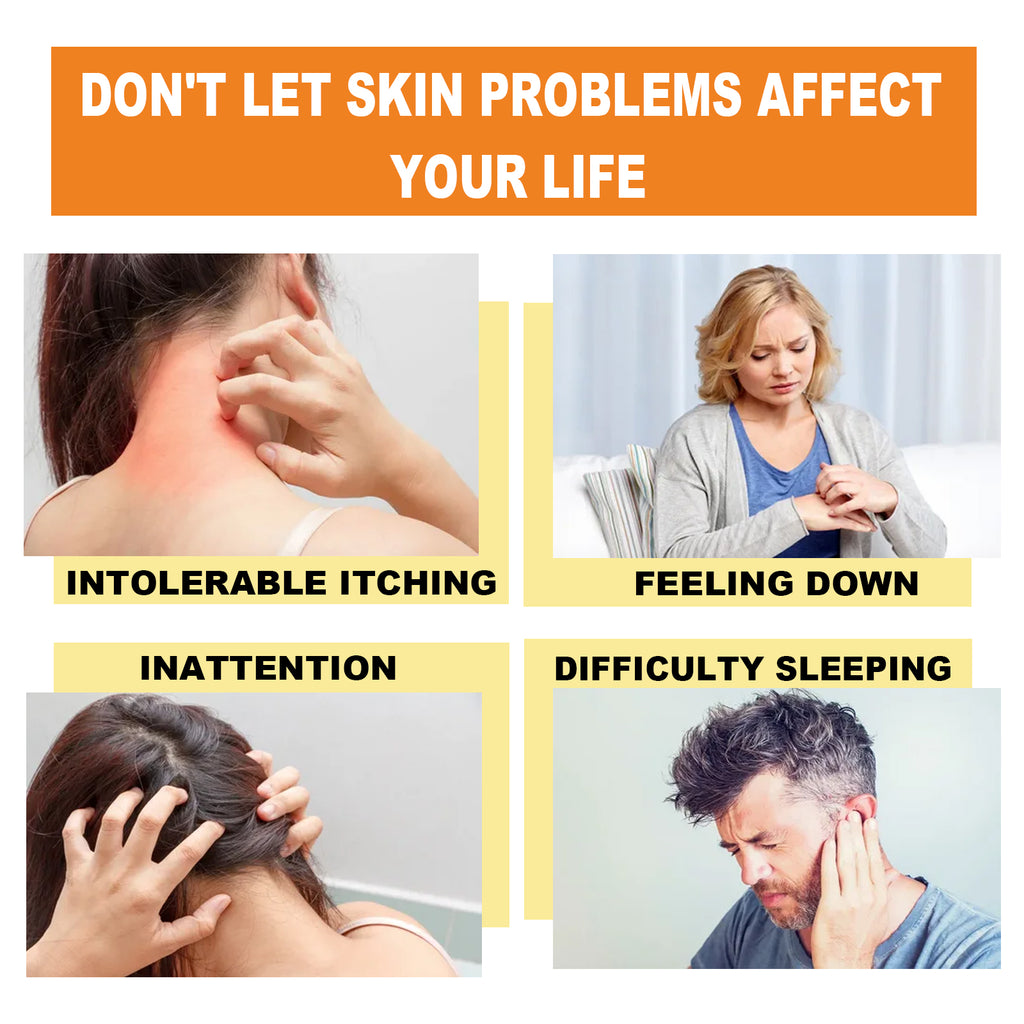Crème Venin d'Abeille Psoriasis — Anti-Démangeaisons, Réparatrice & Hydratante