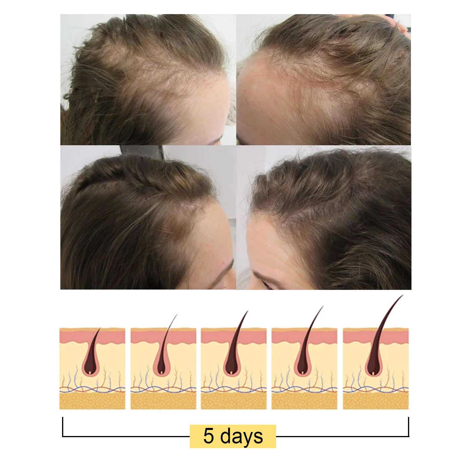 Savon Shampoing Gingembre — Hydrate Pointes & Racines, Cuir Chevelu Sain