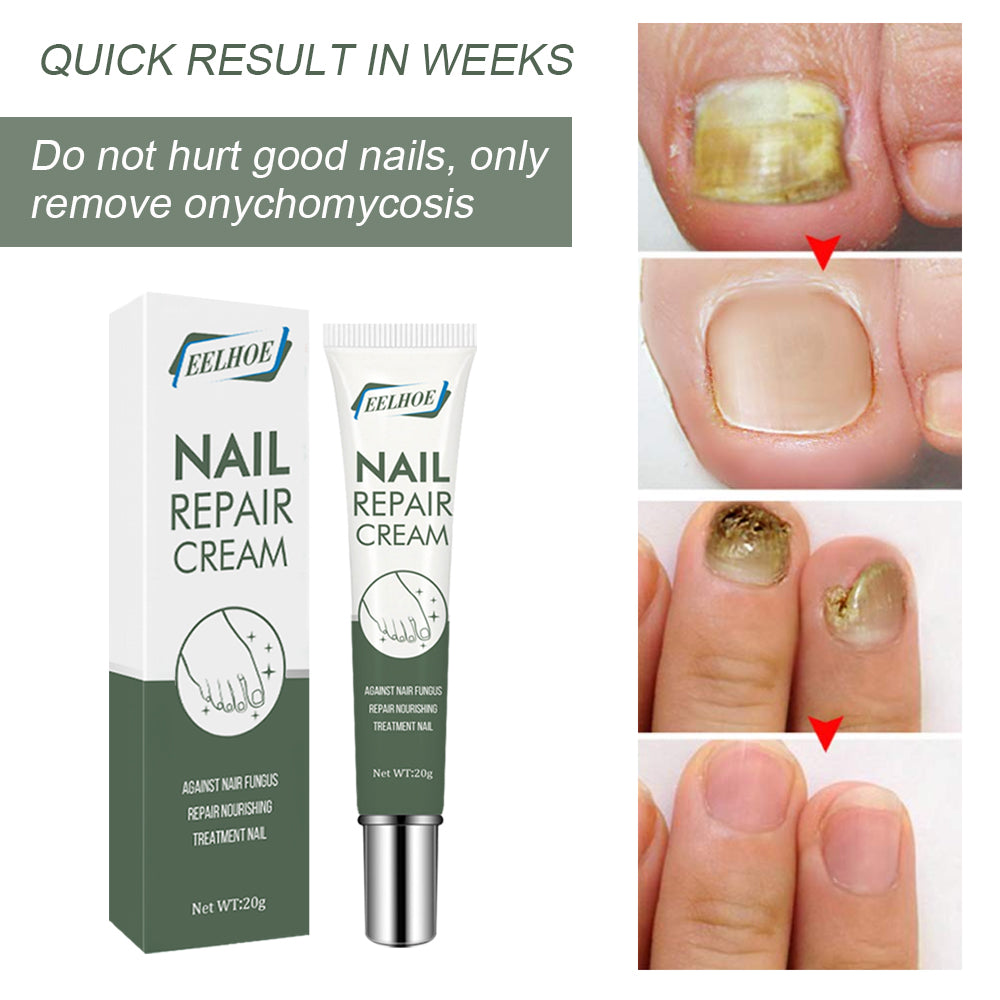 Crème Soin Ongles & Pieds — Réparatrice, Nourrissante & Ongles Renforcés