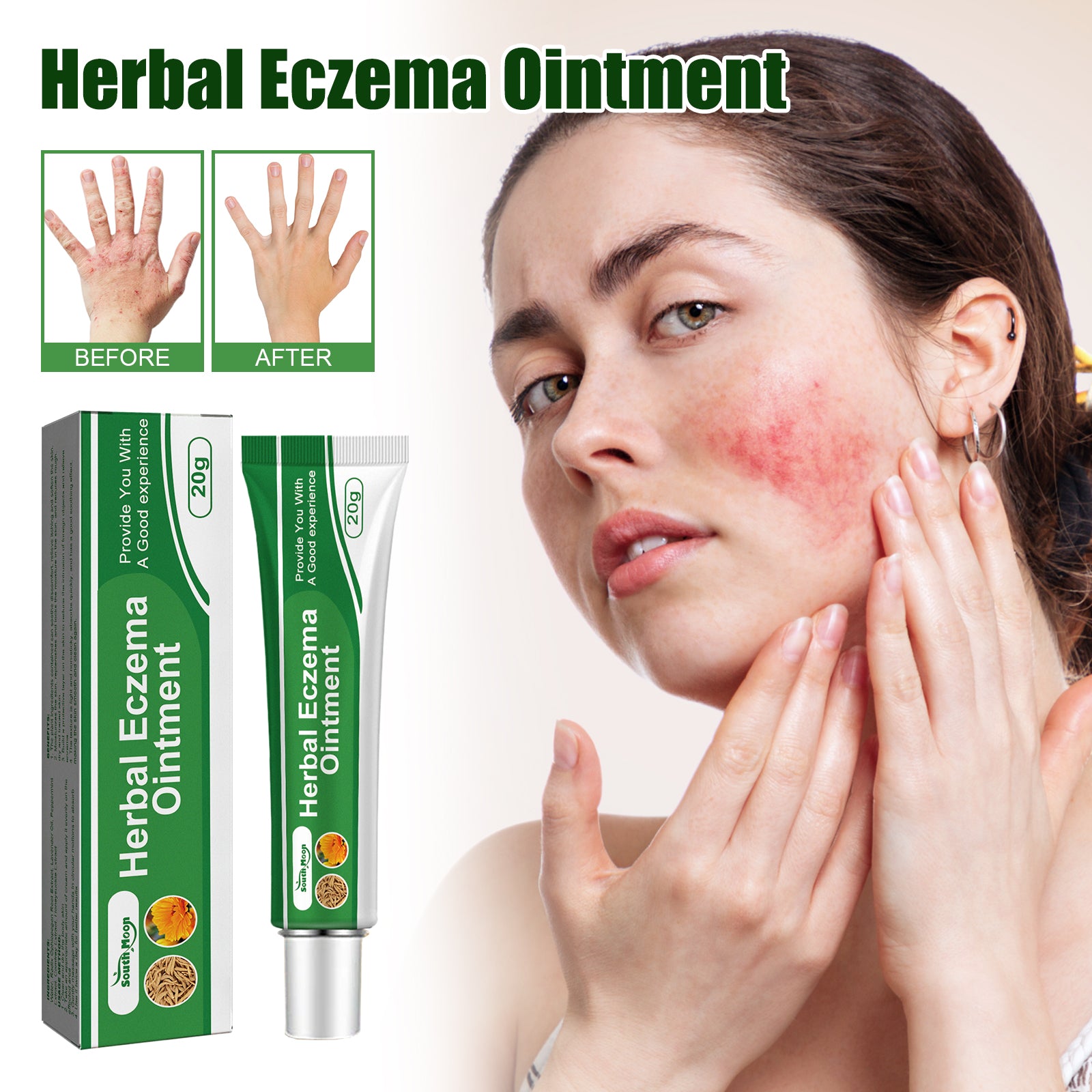 Pommade Herbes Eczema — Anti-Rougeurs, Anti-Démangeaisons & Réparatrice Mains & Pieds
