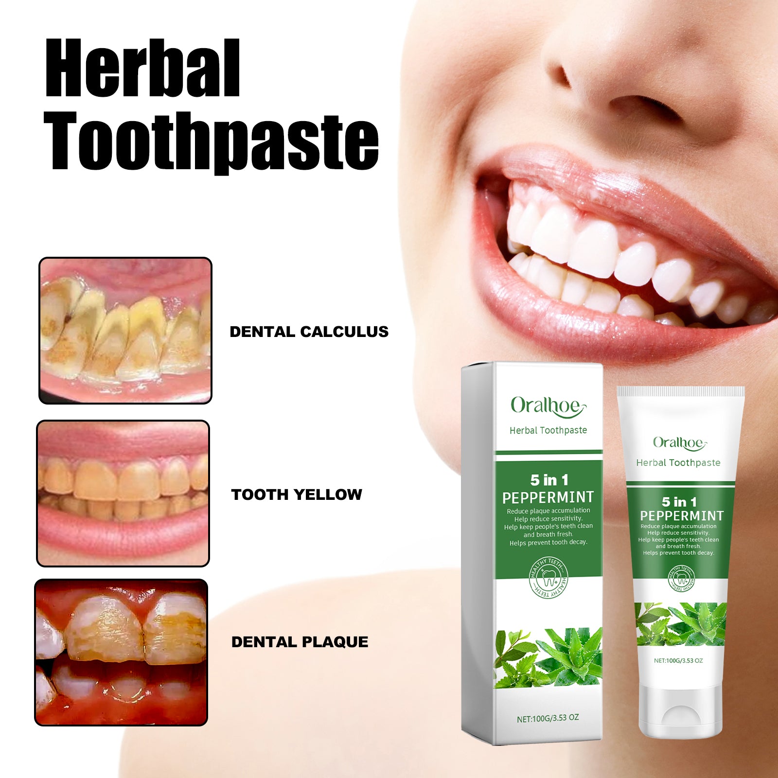 Dentifrice Aloe Vera Blanchissant — Anti-Taches, Haleine Fraîche & Dents Éclatantes